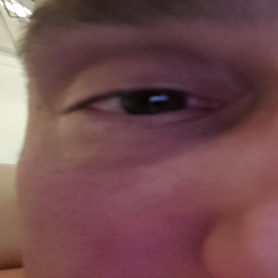 TLKNI